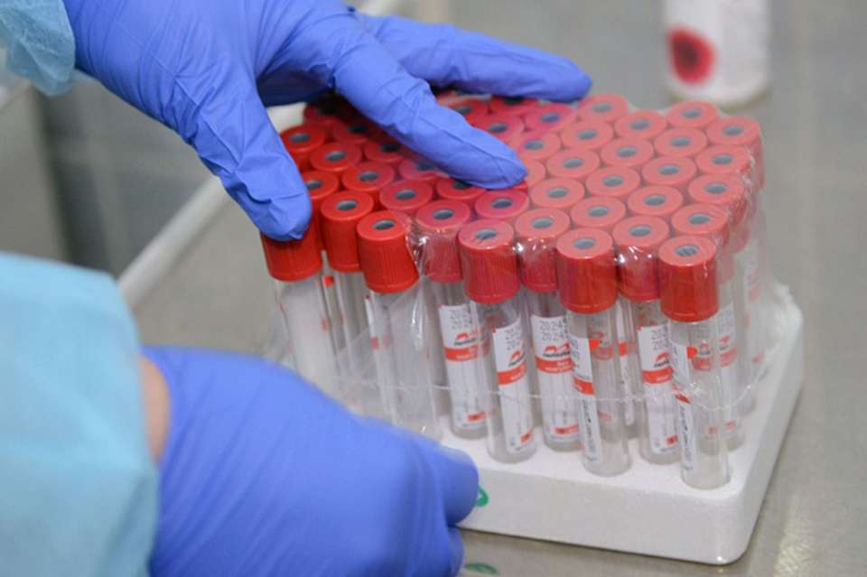 За сутки пять новых случаев заражения коронавирусом зарегистрировано в Липецкой области