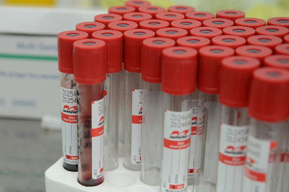 Число заболевших коронавирусом в Липецкой области перевалило уже за сотню