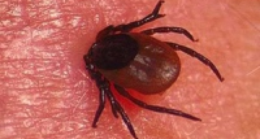 Уже 20 жителей Липецка и области заразились от клещей