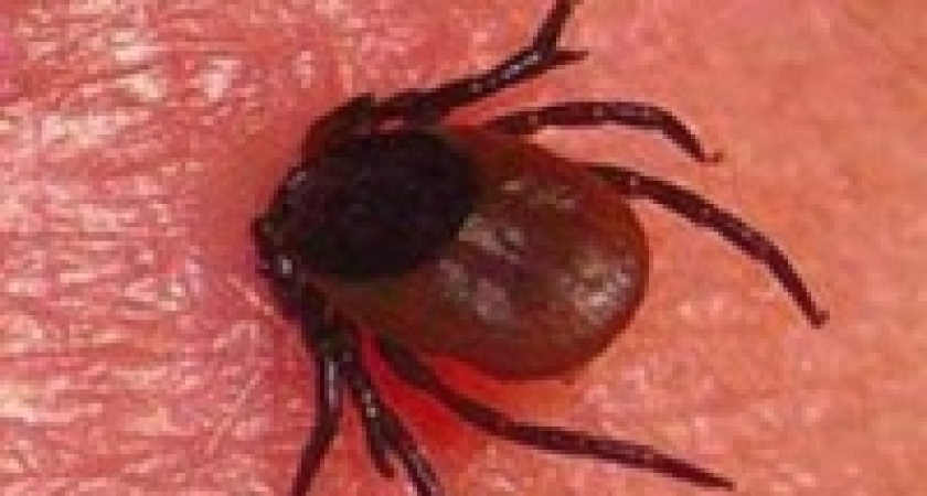 Клещи продолжают наступление 