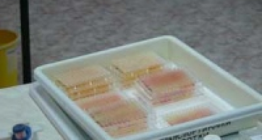 Инфекции наступают на Липецк