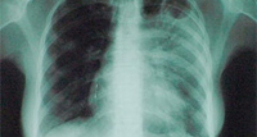 Легли в больницу по решению суда