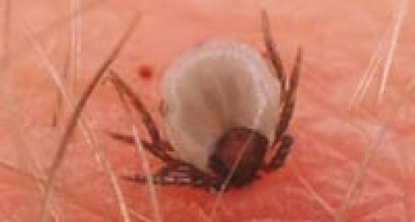 Клещи заразили четверых жителей области