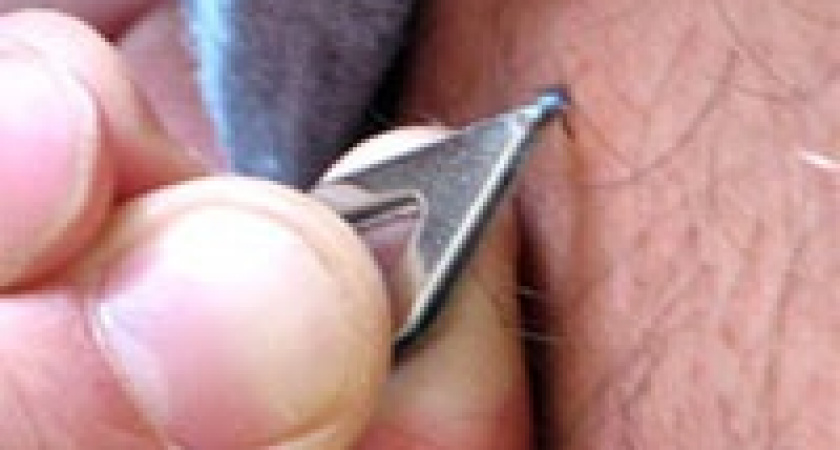 Малярия и болезнь Лайма в Липецке