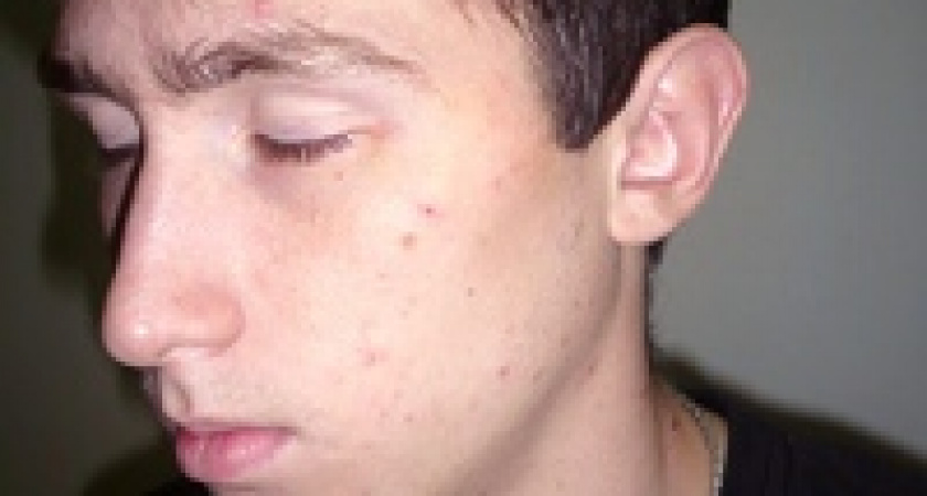 В Нижегородской области подростка кастрировали на допросе в милиции