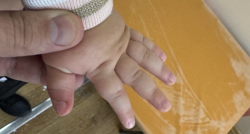 Липецкие хирурги освоили сложные операции по реконструкции детской кисти