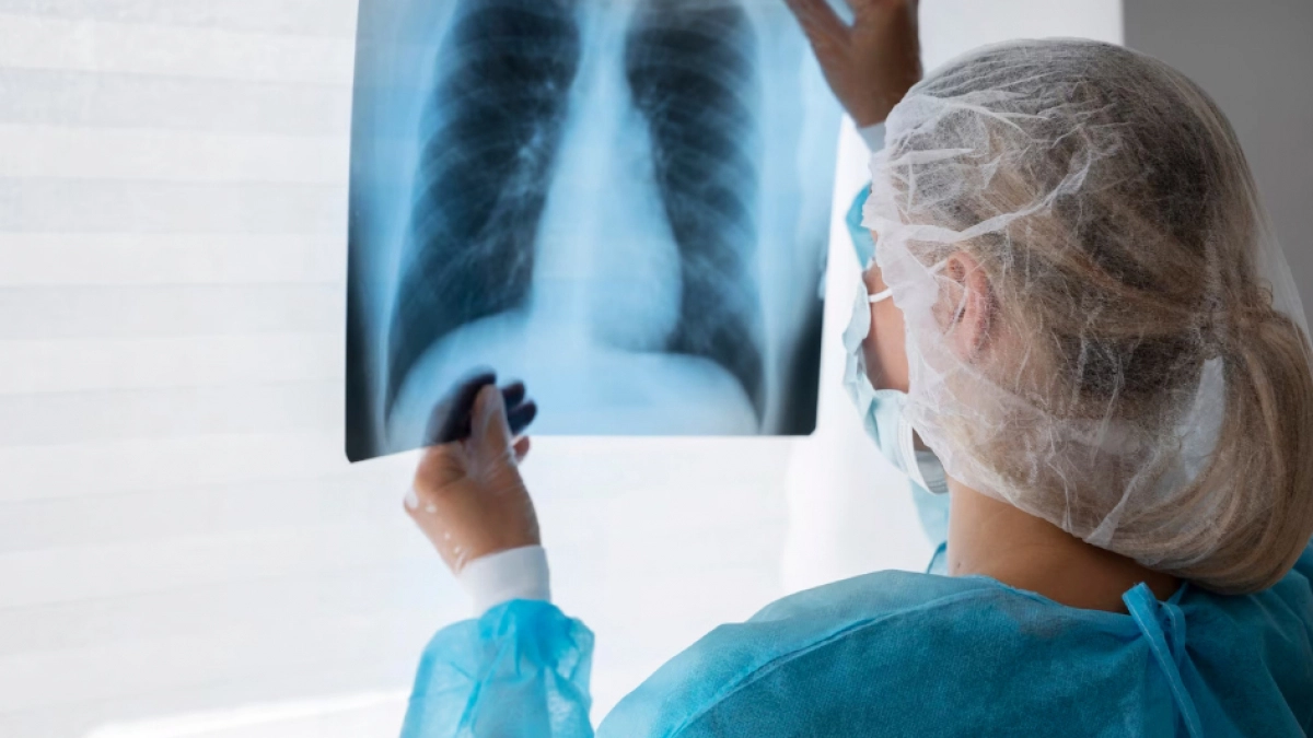 В Липецкой области работает горячая линия по профилактике туберкулеза